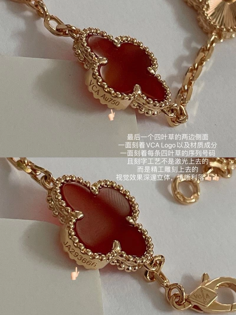 OdorResistant Vca Bracelets 255327
